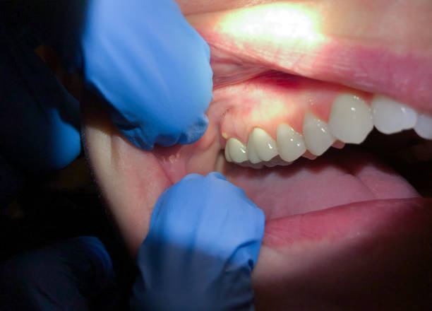 Best Emergency Orthodontic Repairs in Cache, OK