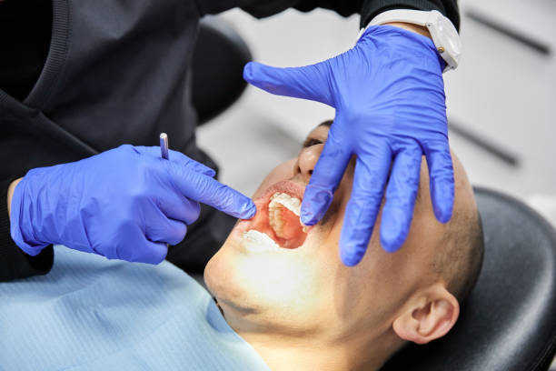 Best Broken or Chipped Tooth Repair in Cache, OK