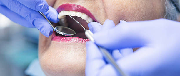 Best Emergency Wisdom Tooth Extraction in Cache, OK